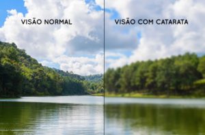 visão normal versus visão com catarata